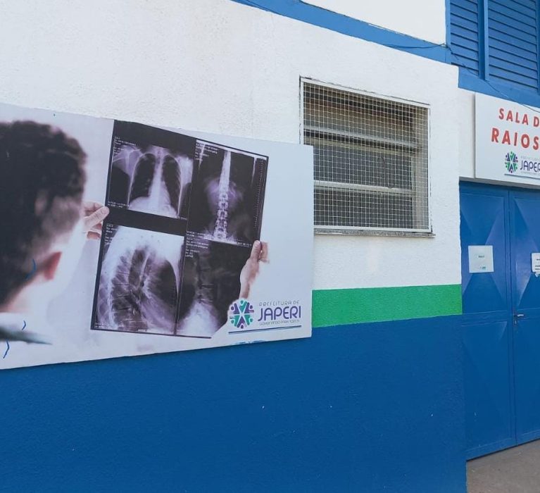 Programa Fila Zero de Cirurgias Eletivas faz aumentar volume de exames de Raio-x, em Japeri